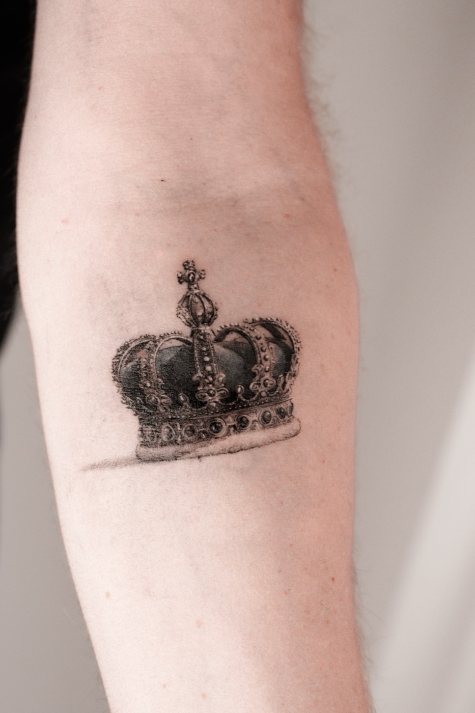 Crown healed